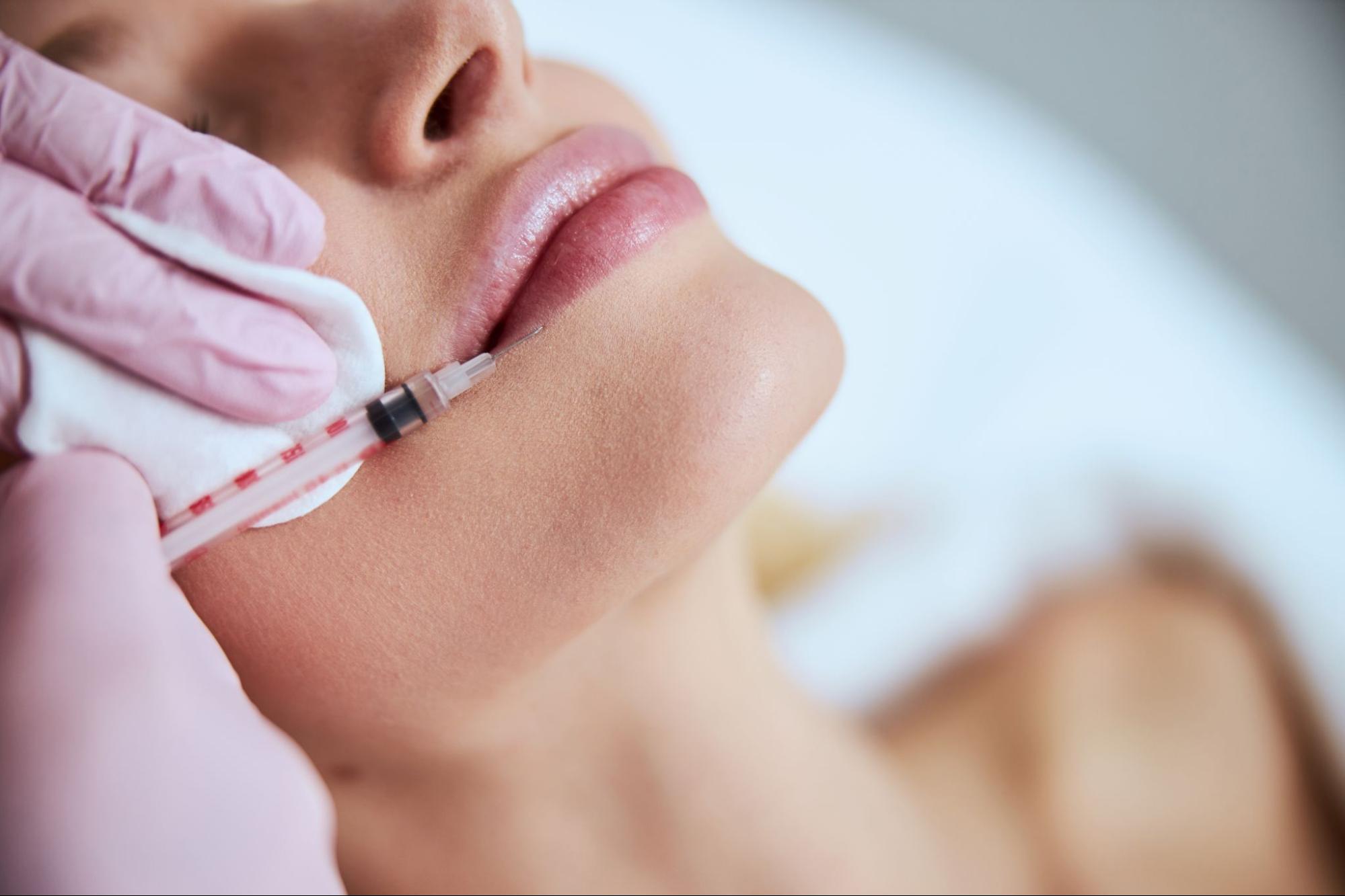 hialuronidasa labios